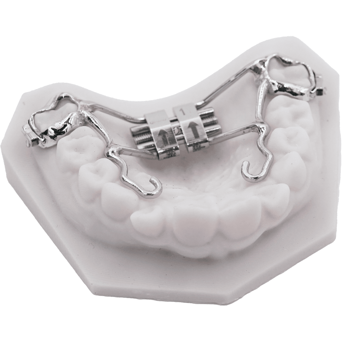 Infinity RPE ODL Ortho Lab's Comprehensive 3D Printed RPE Experience ODL Orthodontic Labs