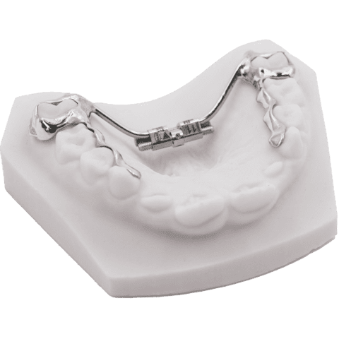 Infinity RPE | Innovative 3D-Printed Rapid Palatal Expanders
