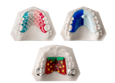 Lower Hawley Retainer: Complete Guide to Post-Braces Care & Maintenance ...