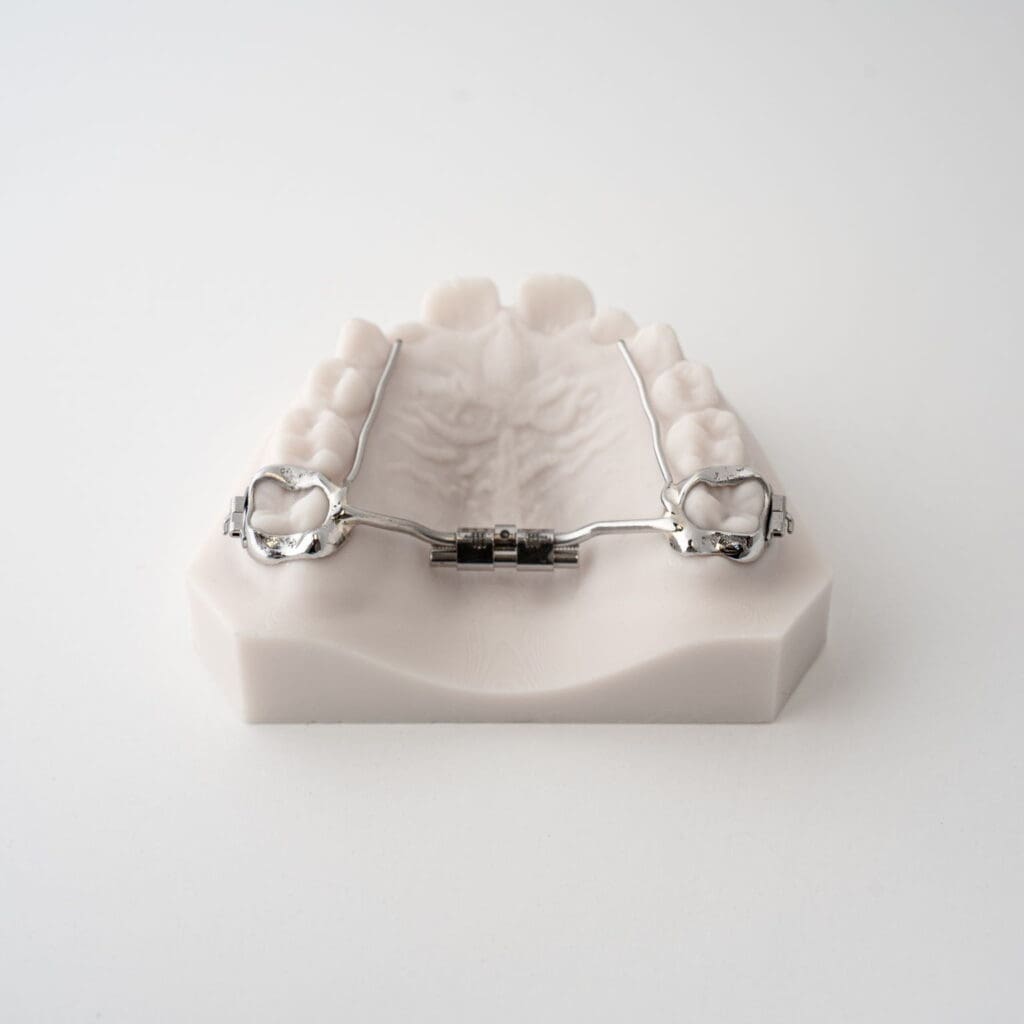 odl ortho Rapid Palatal Expanders Compact RPE 2