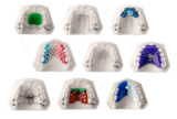 Product Lines | Orthodontic Appliances & Devices | ODL